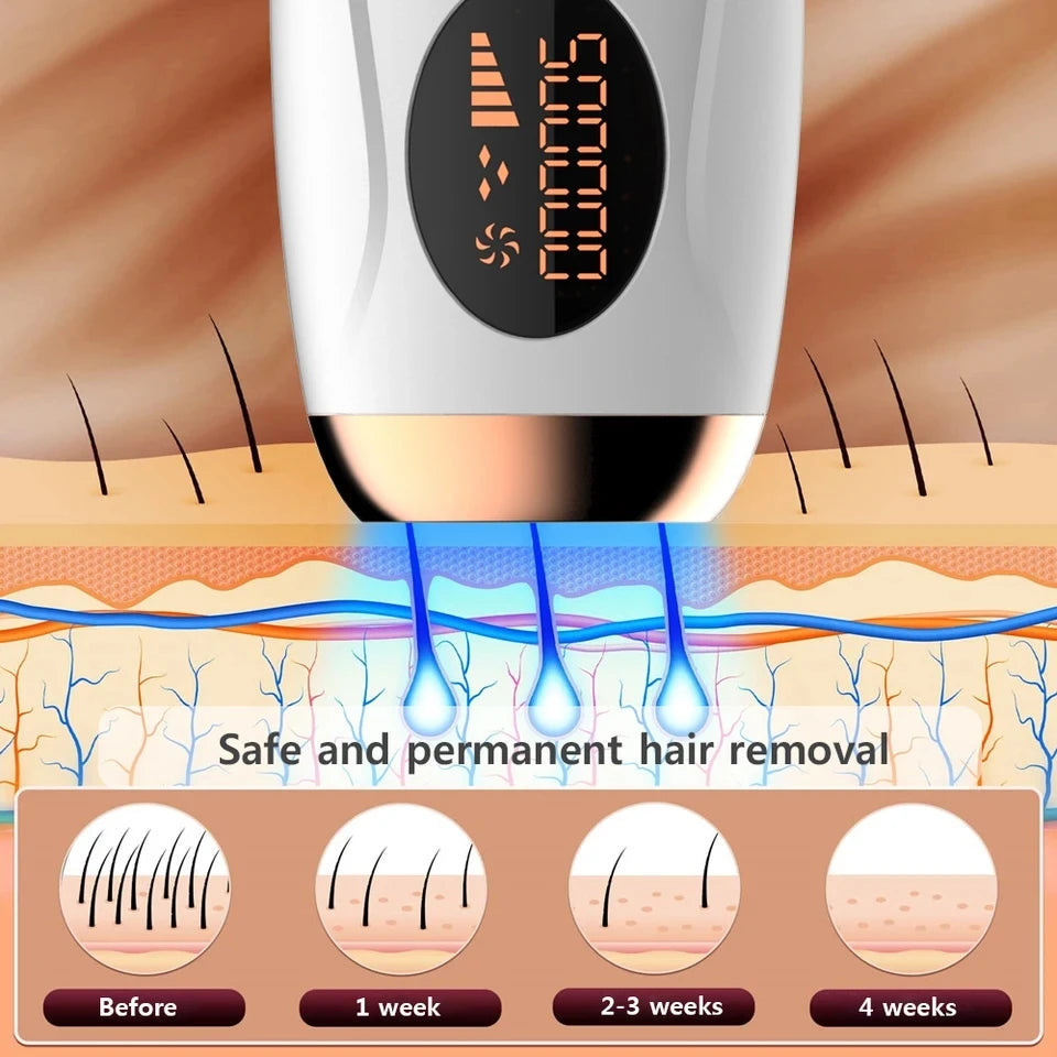 Zanve Professional IPL Laser Hair Remover