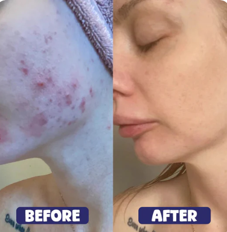Before - Sarah